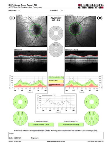 Optic Disc Drusen in a child (non Calcified)
Fluorescein angiography shows no leakage
