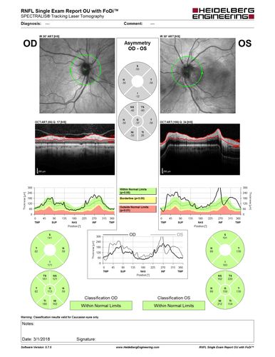 Neuroretinitis and Multifocal Retinitis
62 year old female with vision loss in the left eye to 20/160. Positive Bartonellas IgG.  Vision recovered in 2 months.  She was treated with Oral Erythromycin BID for 2 weeks.
