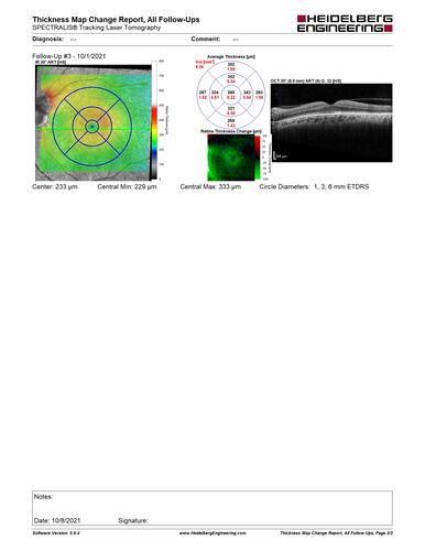 Neuroretinitis left eye - recovered with no therapy - possible B pertussis
57 year old female The patient has had blurred vision in the left eye and there is a haze across the top of the vision.Â  This started about 2 weeks ago.Â  The right eye is OK.Â  She has sleep apnea and uses the machine.Â  The left eye is becoming more and more painful for the last two weeks.Â  The pain is like a stabbing in the eye that comes and goes.Â  She also has some pain on eye movement.Â  The patient has been going to Moffit for possible reconstructive surgery for the lymphedema.
PMHx â€“ Sleep apnea, Breast Cancer, Adult lymphedema, 
Meds: GabapentinÂ 
VA OD: Dcc20/25-1
VA OS: Dcc20/100-2
AC quiet OU.  1 + NS cataract OU
IOP: TP: OD:15 OS:17
