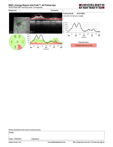 Neuroretinitis left eye - recovered with no therapy - possible B pertussis
57 year old female The patient has had blurred vision in the left eye and there is a haze across the top of the vision.Â  This started about 2 weeks ago.Â  The right eye is OK.Â  She has sleep apnea and uses the machine.Â  The left eye is becoming more and more painful for the last two weeks.Â  The pain is like a stabbing in the eye that comes and goes.Â  She also has some pain on eye movement.Â  The patient has been going to Moffit for possible reconstructive surgery for the lymphedema.
PMHx â€“ Sleep apnea, Breast Cancer, Adult lymphedema, 
Meds: GabapentinÂ 
VA OD: Dcc20/25-1
VA OS: Dcc20/100-2
AC quiet OU.  1 + NS cataract OU
IOP: TP: OD:15 OS:17
