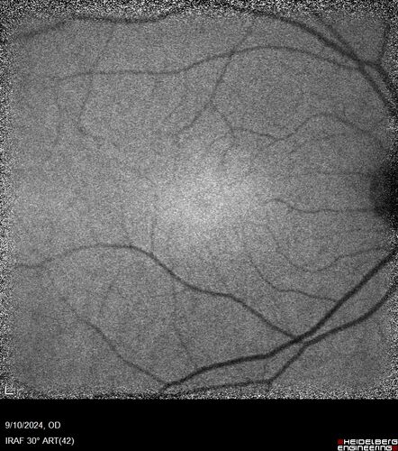 Normal-IR_30_Deg_28629.jpg