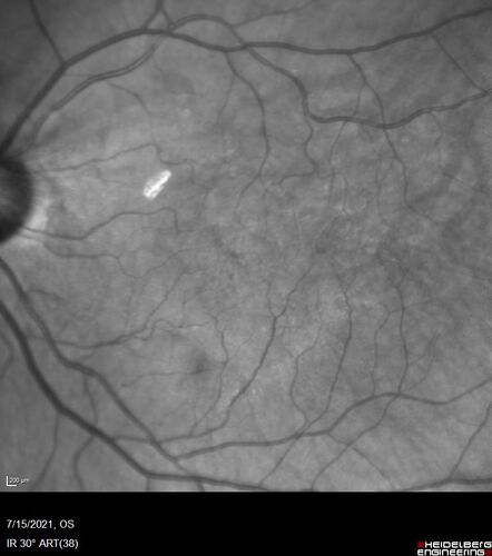 Normal Near-infra-red Reflelctance  01
