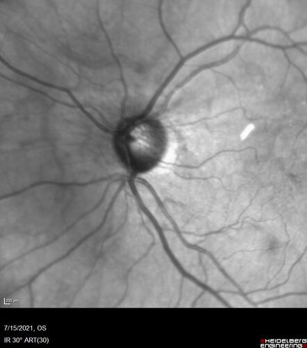 Normal Near-infra-red Reflelctance  02
