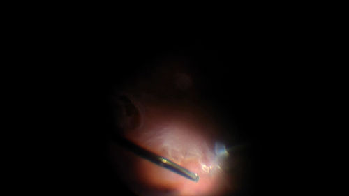 RD_lattice.jpg