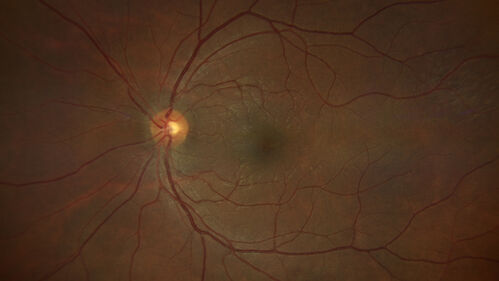 Commotio - Bungee cord injury 2 days ago
