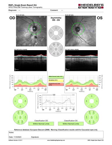 Serpiginous choroiditis in the right eye
68 year old female with spots in vision in the right eye for 2 months.  She has a history of MS.  The vision is 20/32 in both eyes.  She was treated with high dose steroids and transitioned to methotrexate and the right eye quieted  down.
