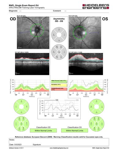 Syphilitic optic neuritis
Two weeks ago she woke up with blurred vision in the left eye.  She usually gets up at 5 AM.  Then she noticed a gray spot in the left eye that did not go away.  This is new for her.  The gray spot is not getting any better or worse in the left eye. (4/4/23)
Systemic Meds: Lisinopril 40 mg. metformin hydrochloride 1000 MG. nifedipine 30mg 
VA OD: sc20/80 PH20/50 NscJ10
VA OS: sc2'/200 Nsc20/400
IOP: TP: OD:15 OS:16 
No AC or vitreous cells - later images was with second eye involved with uveitis.  Patient received IV PCN and was lost to follow-up
