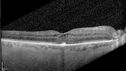 Filename=CME2_Chemo_125315_071025_12.jpg
Filesize=215KiB
Dimensions=770x433
Date added=Aug 17, 2025 CME2_Chemo_125315_071025_12.jpg