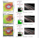 Filename=CME3_Chemo_125315_maps_14.JPG
Filesize=1496KiB
Dimensions=1697x1644
Date added=Aug 17, 2025 CME3_Chemo_125315_maps_14.JPG