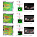 Filename=CME3_Chemo_125315_maps_16.JPG
Filesize=1402KiB
Dimensions=1632x1632
Date added=Aug 17, 2025 CME3_Chemo_125315_maps_16.JPG