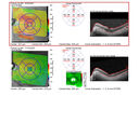 Filename=CME3_Chemo_125315_maps_17.JPG
Filesize=890KiB
Dimensions=1632x1620
Date added=Aug 17, 2025 CME3_Chemo_125315_maps_17.JPG