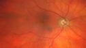 Filename=CME_Chemo_125315_032025_01.jpg
Filesize=2884KiB
Dimensions=2373x1334
Date added=Aug 17, 2025 CME_Chemo_125315_032025_01.jpg