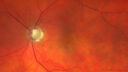 Filename=CME_Chemo_125315_032025_02.jpg
Filesize=2451KiB
Dimensions=2182x1228
Date added=Aug 17, 2025 CME_Chemo_125315_032025_02.jpg