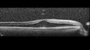Filename=CME_Chemo_125315_032025_03.jpg
Filesize=719KiB
Dimensions=1536x864
Date added=Aug 17, 2025 CME_Chemo_125315_032025_03.jpg