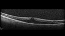 Filename=CME_Chemo_125315_032025_04.jpg
Filesize=666KiB
Dimensions=1536x864
Date added=Aug 17, 2025 CME_Chemo_125315_032025_04.jpg
