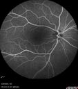 Filename=CME_Chemo_125315_032025_08.jpg
Filesize=368KiB
Dimensions=768x868
Date added=Aug 17, 2025 CME_Chemo_125315_032025_08.jpg
