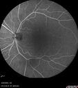 Filename=CME_Chemo_125315_032025_10.jpg
Filesize=384KiB
Dimensions=768x868
Date added=Aug 17, 2025 CME_Chemo_125315_032025_10.jpg