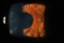 Filename=CRAO-NVI2.jpg
Filesize=30KiB
Dimensions=750x514
Date added=Aug 13, 2025 CRAO-NVI2.jpg
