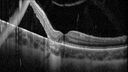 ChronicRD1_126763_082825_05.jpg