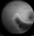 Dystrophy-genenegative_arfer_040821_15.jpg