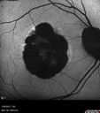 MacLaserScar-pohs_jolin_012617_08.jpg