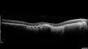 MacLaserScar-pohs_jolin_012617_11.jpg