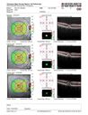 PatternDystrophy_96645_fu_23.JPG