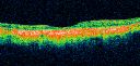 amddrgeographicatropylaser15.jpg