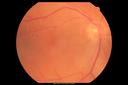 autoimmune-csr_rilo_020915_01.png