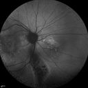 autoimmune-csr_rilo_020915_06.jpg