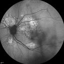 autoimmune-csr_rilo_020915_07.jpg