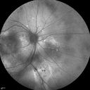 autoimmune-csr_rilo_020915_23.jpg