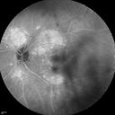 autoimmune-csr_rilo_020915_24.jpg