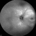 autoimmune-csr_rilo_020915_25.jpg