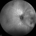 autoimmune-csr_rilo_020915_26.jpg