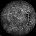 autoimmune-csr_rilo_020915_29.jpg