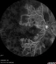 crvo-97822-062623_12.jpg