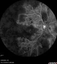 crvo-97822-062623_13.jpg