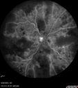 crvo-97822-062623_14.jpg
