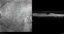 csr-testing-asymptomatic-goodva_281229.jpg