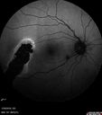 csr-testing-asymptomatic-goodva_281329.jpg