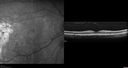 csr-testing-asymptomatic-goodva_281529.jpg