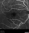 csr_fibrin21_mada_050117_15.jpg