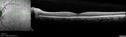 discedema-post-carotid-endarterectomy-mides_04.jpg