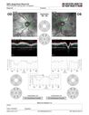 dme_htn-choroid_padod1_052523_17.JPG