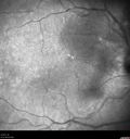 ipcv_doke_090315_10.jpg