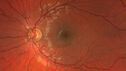 migraine_127207_092525_02.jpg