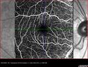 migraine_127207_092525_10.jpg