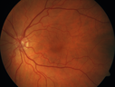 nasal-brao_inmur_031618_03.png