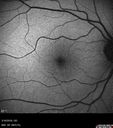 nasal-brao_inmur_031618_06.jpg